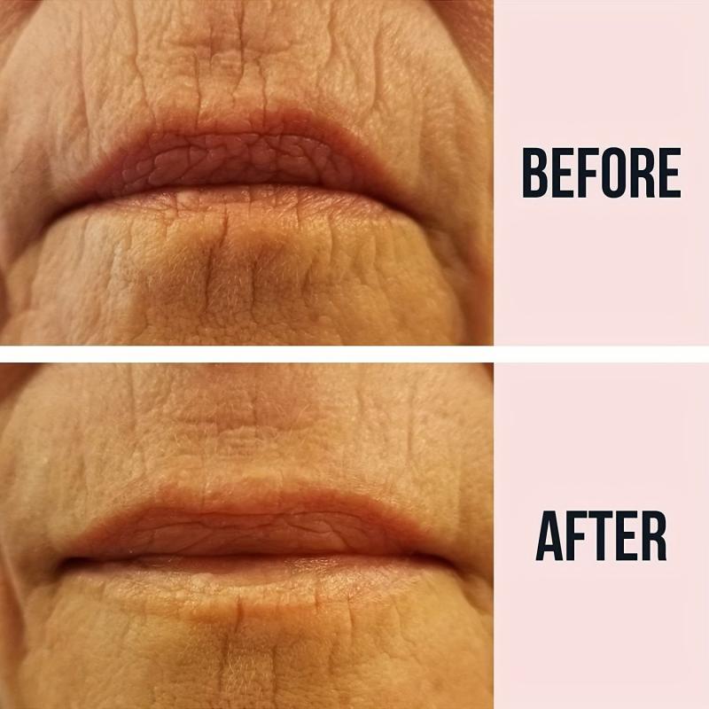 2pcs Silicone Wrinkle Lip Patch for Face Lifting & Repair