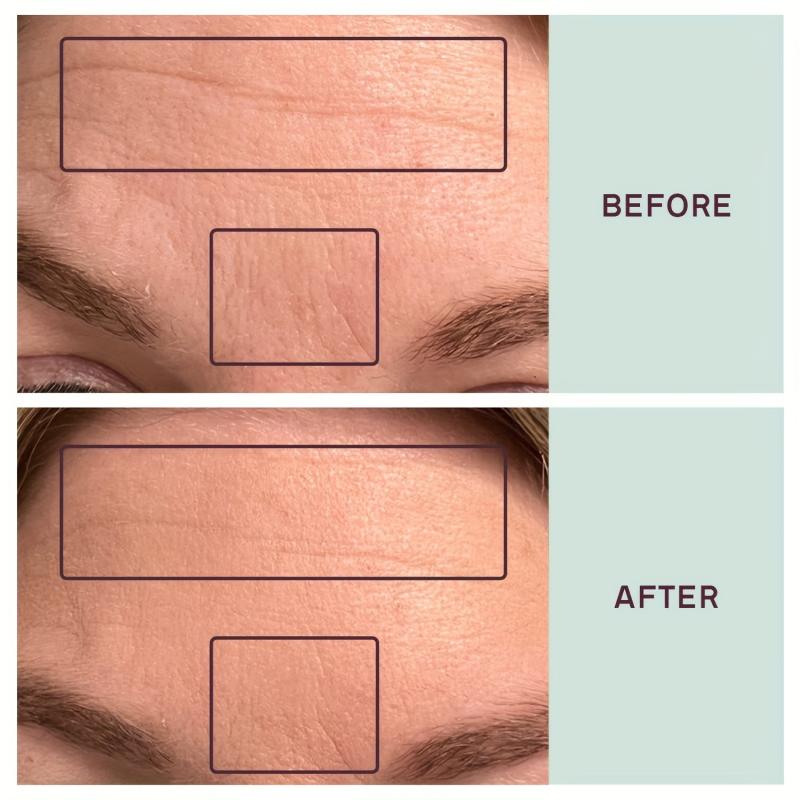 1PC Silicone Wrinkle Forehead Patch Reusable Facial Firming Lift Care Tools