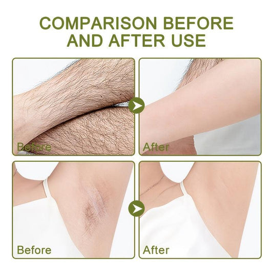 Hair Removal Kit with Cream and Wax Strips - Painless and Effective