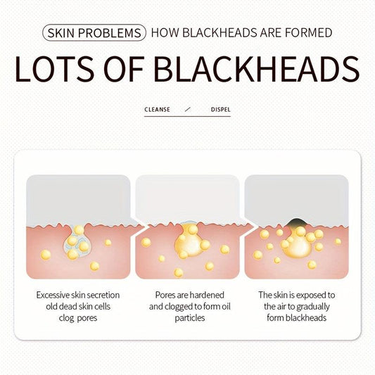 Blackhead Remover Strips Deep Cleansing Nose Strips