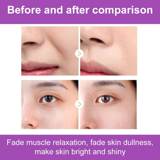 Smooth Nasolabial Folds Mask Reduce Aging Fine Wrinkles