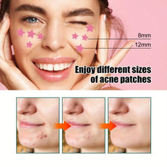 224pcs Hydrocolloid Acne Patches for Face and Skin