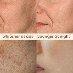 2-in-1 Day and Night Cream Bundle for Glowing Skin