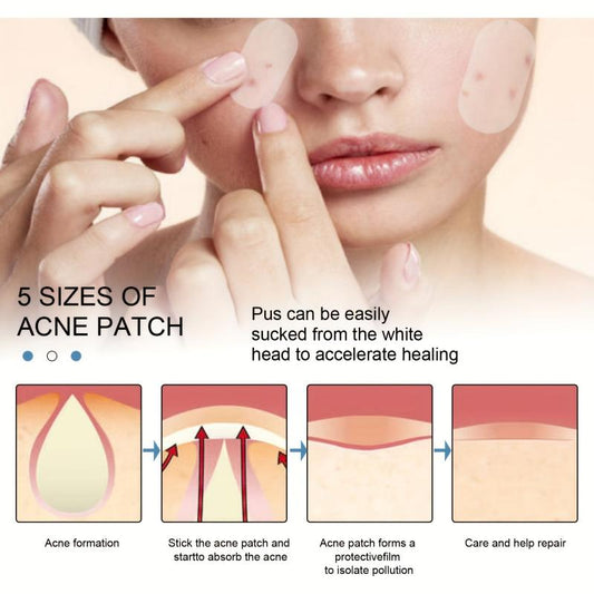 EELHOE Invisible Acne Patch 80 Stickers Waterproof Concealer