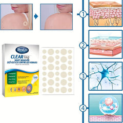 Acne Patches Hydrocolloid Acne Pimple Patch for Zits Blemishes Spot Stickers
