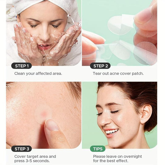 Invisible Makeup Hydrocolloid Acne Patches - 540pcs