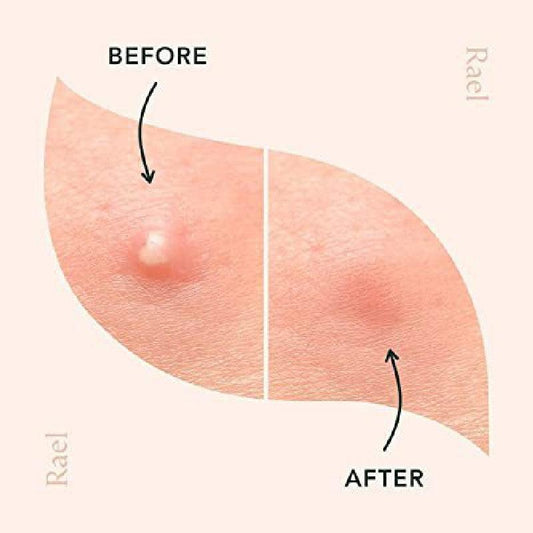 36 48pcs Pimple Patches Hydrocolloid Acne Patches For Face