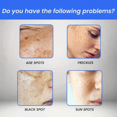 Age Spot Reducing Face Cream, Radiant Skin Tinted Moisturizer