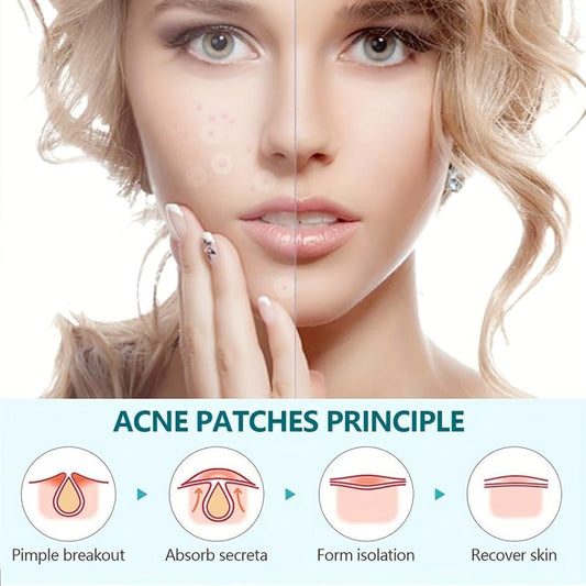 144 Pcs Pimple Patches Hydrocolloid Acne Cover Patches Spot Stickers