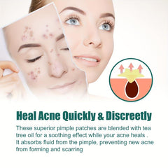 Star Shaped Acne Cover Up Patch - Repair and Hide Acne Marks