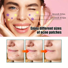 Star Shaped Acne Cover Up Patch - Repair and Hide Acne Marks