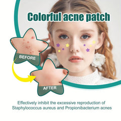 Star Shaped Acne Cover Up Patch - Repair and Hide Acne Marks