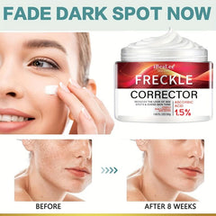 Freckle Cream Firming Skin Even Tone Dark Spot Remover Radiant Skin