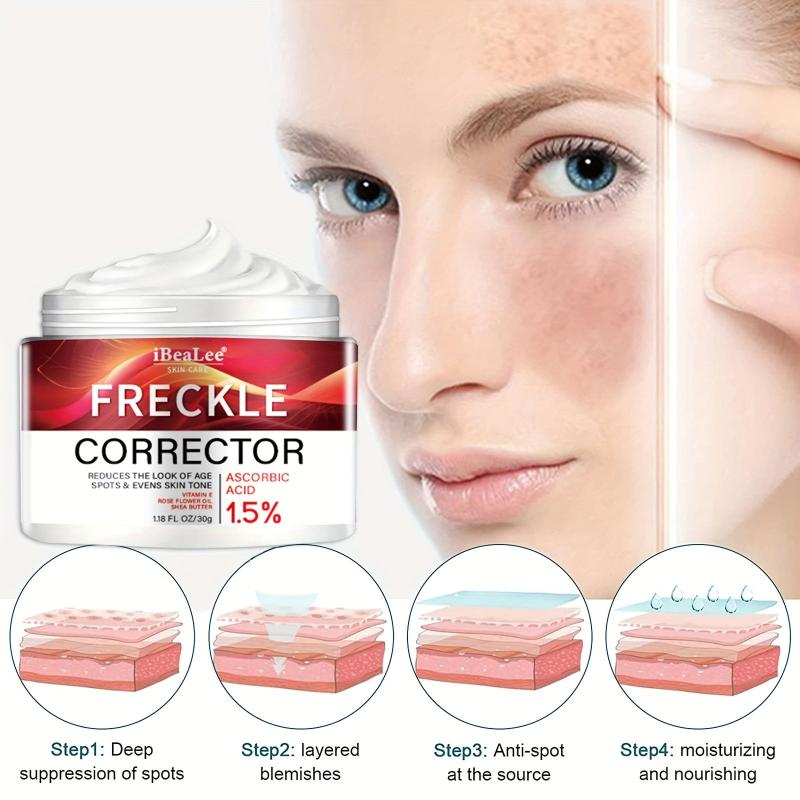 Freckle Cream Firming Skin Even Tone Dark Spot Remover Radiant Skin