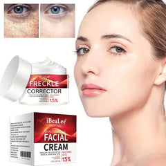 Freckle Cream Firming Skin Even Tone Dark Spot Remover Radiant Skin