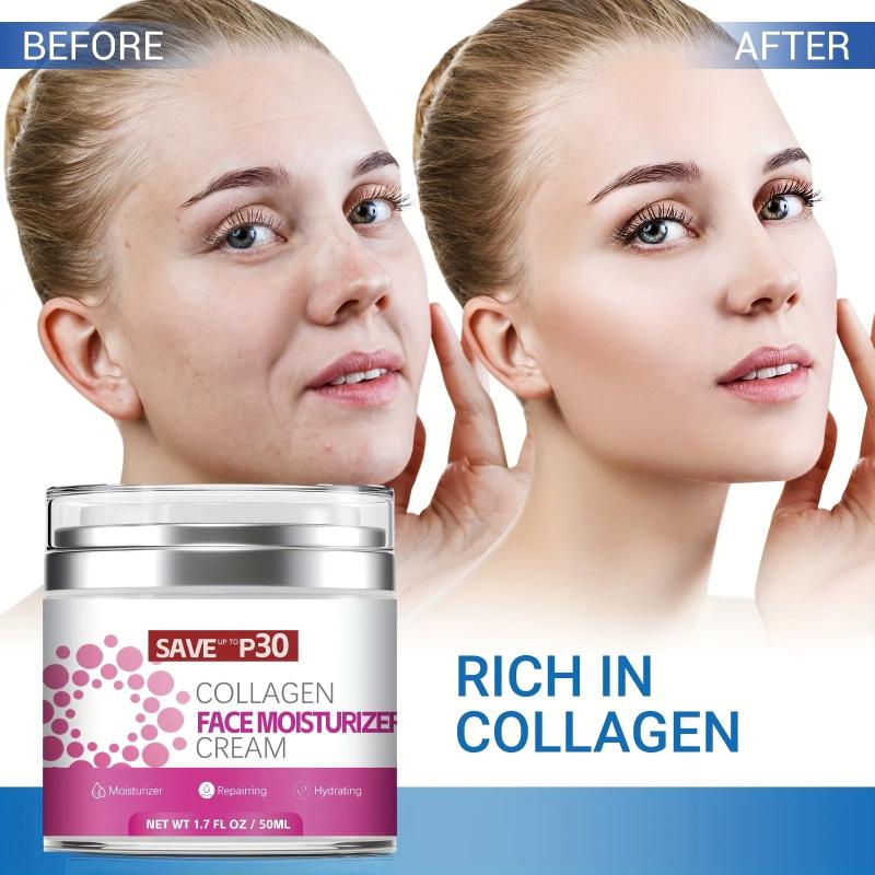 Collagen Retinol Moisturizer Hyaluronic Acid Fading Fine Lines Wrinkles Melasma
