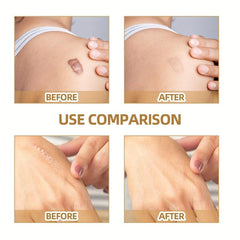 Skin Invisible Concealer Sticker Scar Tattoo Cover Up Waterproof