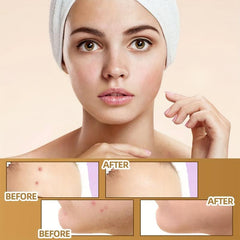 Skin Invisible Concealer Sticker Scar Tattoo Cover Up Waterproof