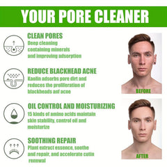 Mild Amino Acid Mask Acne Removing Blackheads Facial Clay Mask