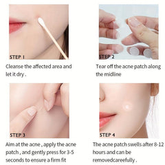 Acne Patches for Face and Skin, Gentle and Effective