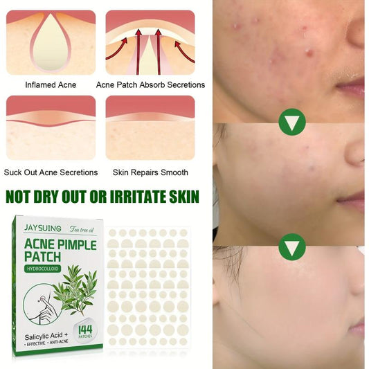 Acne Pimple Patch Vegan Friendly 144 Pcs
