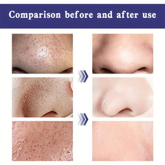Deep Cleansing Nose Blackhead Pore Tightening Strips
