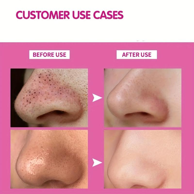 Blackhead Cleansing Nose Patch Acne Peeling Mask Skin Care