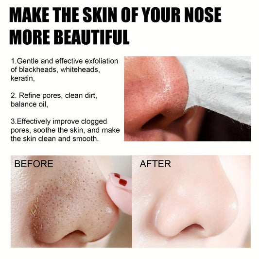 Blackhead Remover Mask 30ml Face Clean Pores Acne Nose Sticks
