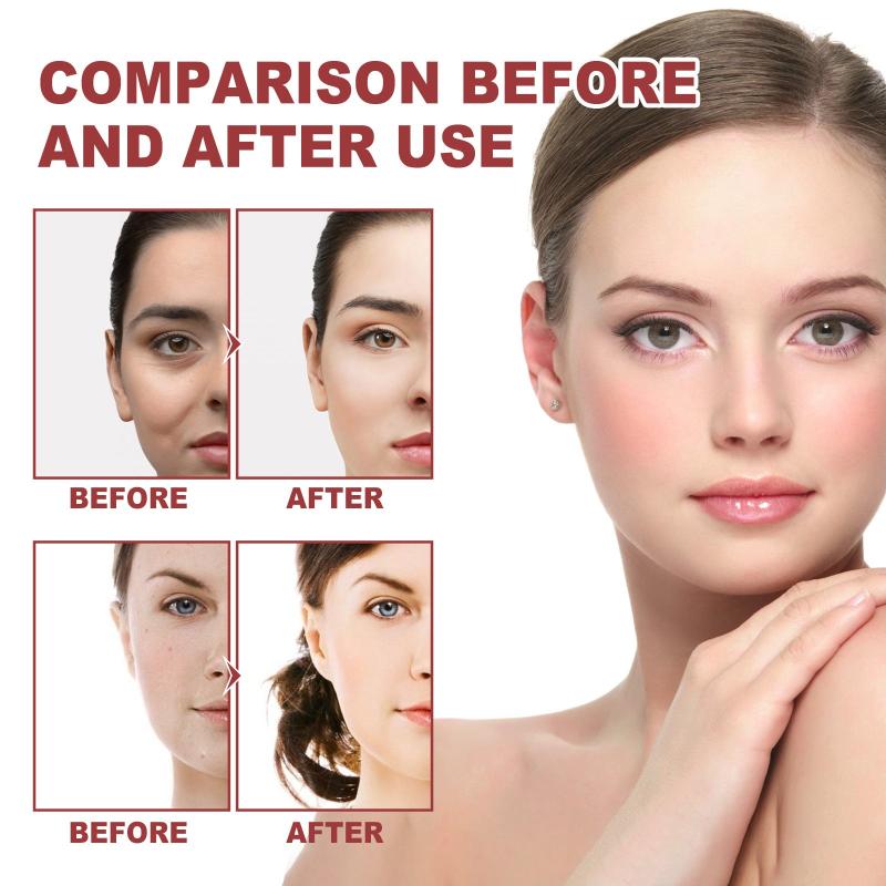Collagen Eye Mask for Dark Circles - Moisturizing and Firming Eye Rejuvenation