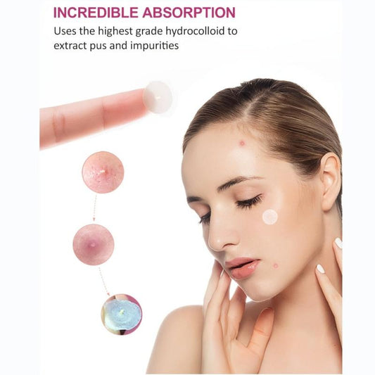 Pink Star Shape Pimple Patches Hydrocolloid Acne Patch