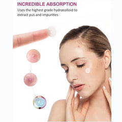 Pink Star Shape Pimple Patches Hydrocolloid Acne Patch