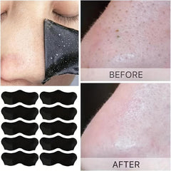 200Pcs Blackhead Remover Nose Strips Deep Cleansing