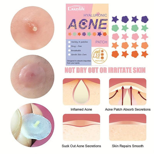 Colorful Acne Stickers 110 Stickers Star Flower Round Shape Acne Sticker