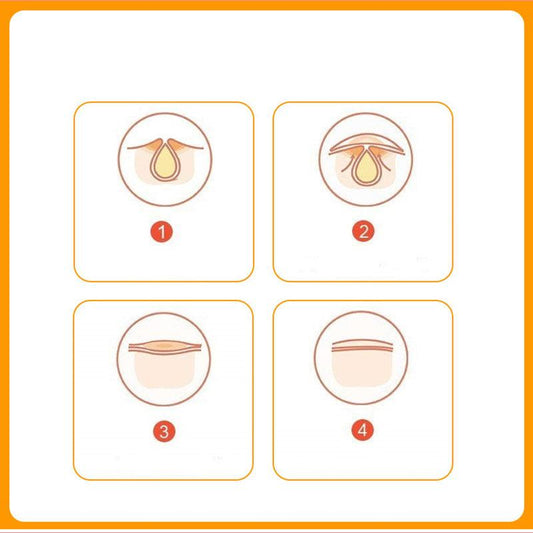 5 Pack Invisible Waterproof Acne Patch Hydrocolloid Concealer