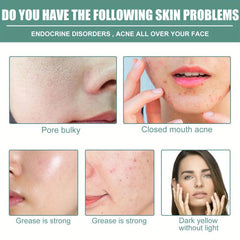 Retinol Serum for Face Firming Fine Lines