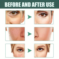 Retinol Serum for Face Firming Fine Lines