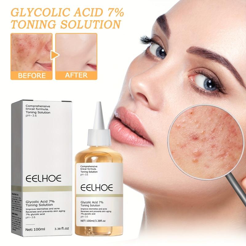 Glycolic Acid Toner for Closed Mouth Acne Removal & Skin Rejuvenation