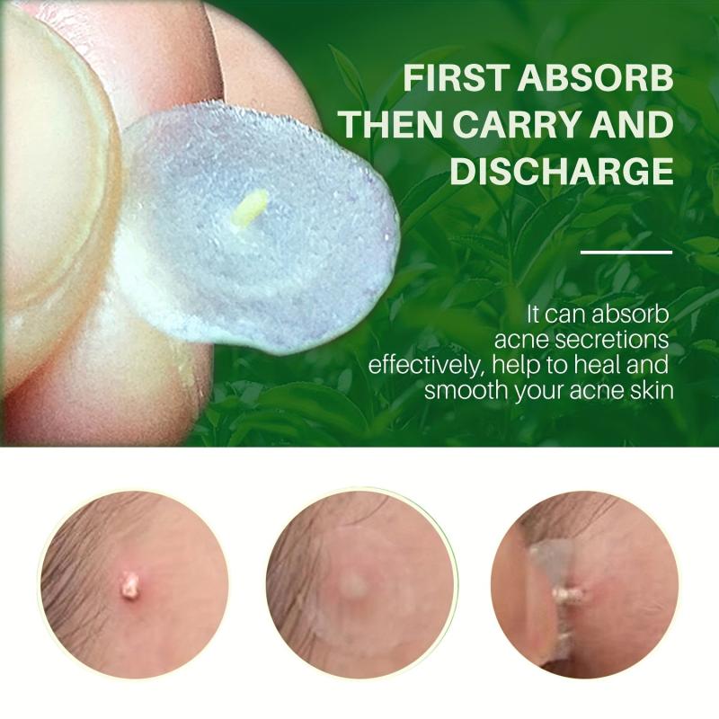 72 Pcs Pimple Patches Hydrocolloid Acne Stickers For Covering Zits Blemishes