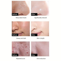Charcoal Massage Balm Exfoliating Cleansing Pore Hydration