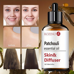 100ml Patchouli Essential Oil - 100% Natural Organic
