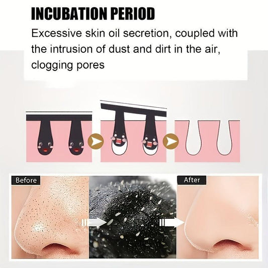 200 Pcs Blackhead Nose Strips Deep Cleansing Nasal Spot Stickers