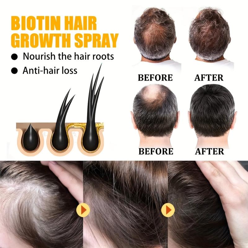 Hair Stronger Cream Biotin Saw Palmetto Hair Vitamins Hair Care