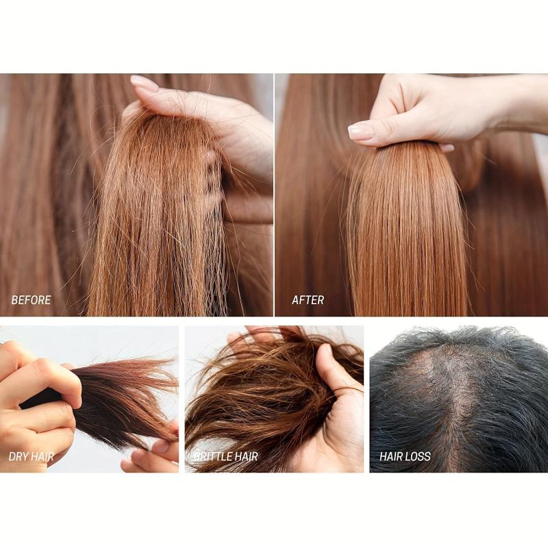 30ml 5 Minoxidil Caffeine Serum Hair Care Serum For Men And Women