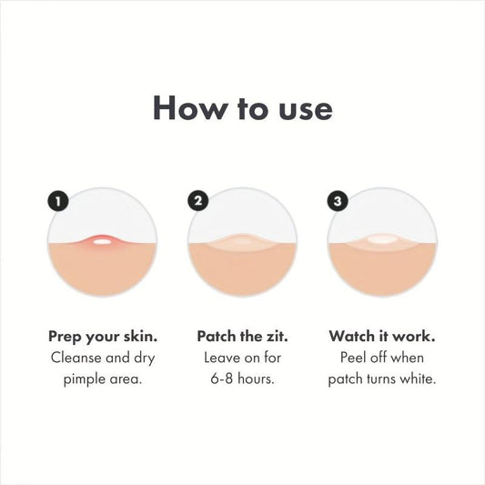 Acne Pimple Patch 36 Counts Vegan Friendly Cover Zits Blemishes Spot Stickers