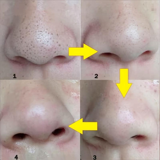 10 Pcs Blackhead Remover Mask Deep Cleansing Skin Care Pore Acne Caring Mask