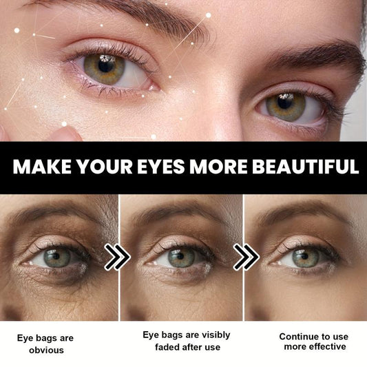 Anti-Aging Eye Cream Dark Circles Puffiness Remover