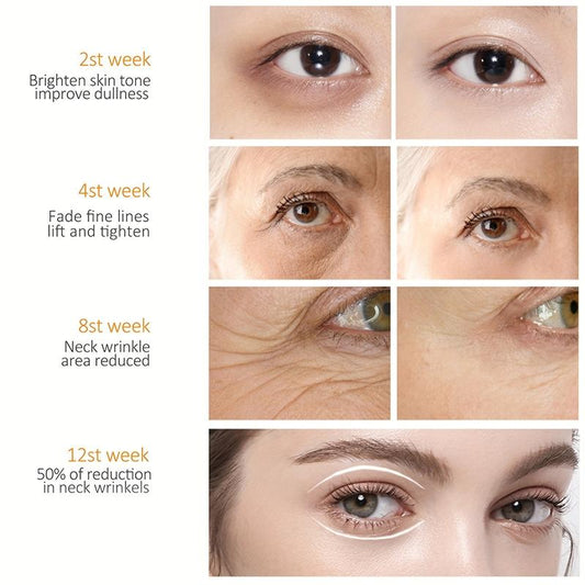 Natural Eye Cream for Dark Circles and Puffiness