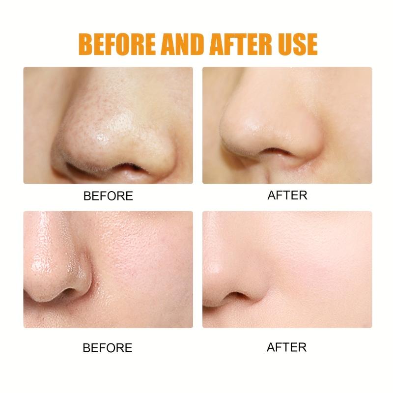 Deep Cleansing Pore Strips - Blackhead Cleanser with Pore Unclogging Tech