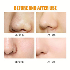 Deep Cleansing Pore Strips - Blackhead Cleanser with Pore Unclogging Tech