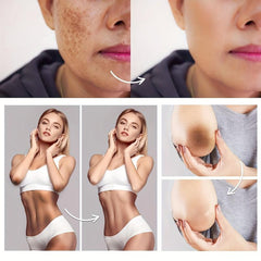 Dark Removal Cream Underarm Armpit Neck Legs Elbows 50g